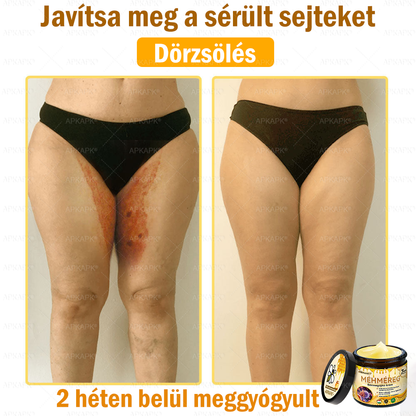 💜💜APKAPK® 𝐌É𝐇𝐌É𝐑𝐄𝐆 Á𝐓𝐅𝐎𝐆Ó 𝐊𝐑É𝐌🥇𝐀 bőrnövedékek 𝐤𝐞𝐳𝐞𝐥é𝐬𝐞 𝐦𝐚𝐠á𝐛𝐚𝐧 𝐟𝐨𝐠𝐥𝐚𝐥𝐣𝐚: é𝐥𝐞𝐭𝐤𝐨𝐫𝐢 𝐟𝐨𝐥𝐭𝐨𝐤, 𝐡𝐞𝐠𝐞𝐤, 𝐬𝐳𝐞𝐦ö𝐥𝐜𝐬ö𝐤, 𝐛ö𝐫𝐧ö𝐯𝐞𝐝é𝐤𝐞𝐤, 𝐭á𝐥𝐲𝐨𝐠𝐨𝐤, 𝐩𝐚𝐭𝐭𝐚𝐧á𝐬𝐨𝐤, 𝐞𝐤𝐜é𝐦𝐚, 𝐩𝐬𝐨𝐫𝐢𝐚𝐬𝐢𝐬, 𝐚𝐜𝐧𝐞 𝐢𝐧𝐯𝐞𝐫𝐬𝐚, 𝐫á𝐧𝐜𝐨𝐤, 𝐛ö𝐫ö𝐫𝐞𝐠𝐞𝐝é𝐬 é𝐬 𝐞𝐠𝐲é𝐛 𝐩𝐫𝐨𝐛𝐥é𝐦á𝐤🔥