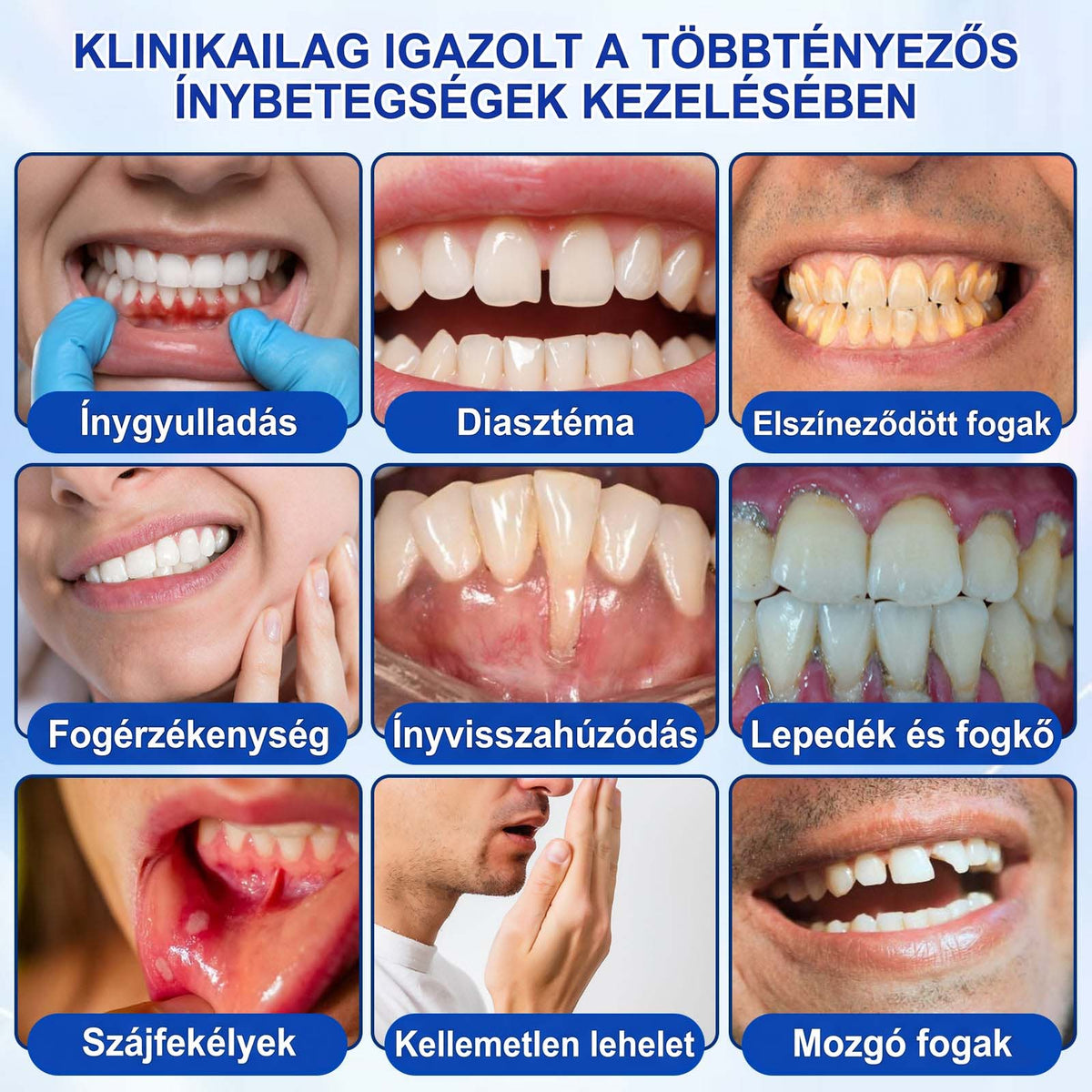 PureShade® 🦷🦷🦷 GumRevive Ínyregeneráló Gél – Az egészségesebb ínyért és magabiztosabb mosolyért 👍