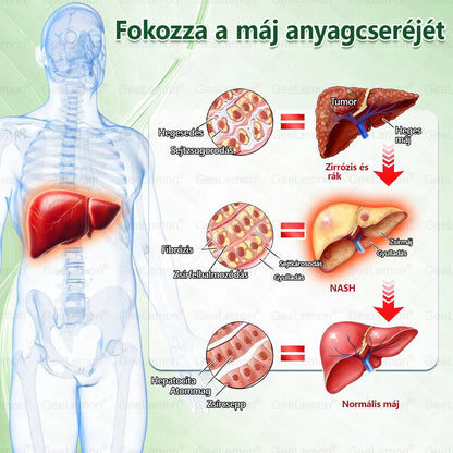 Ajánlott a Semmelweis Kórház által · 👩‍⚕️👩‍⚕️ 𝐆𝐞𝑒𝐿𝑒𝐦𝐨𝐧® Glumasetide 8 az 1-ben Karcsú és Egészséges Nano Mikrotűs Tapasz 🇭🇺