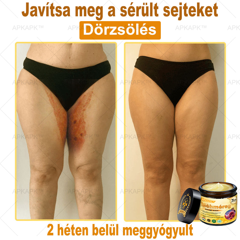 🐝🐝🐝APKAPK® Méhméreg Átfogó Krém🔥 Magyar fejlesztés, magyarországi gyártás és szállítás