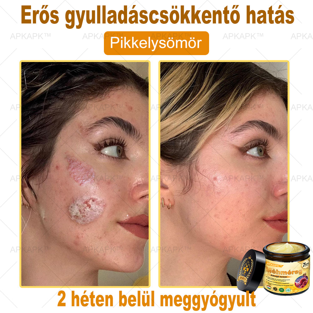 🐝🐝🐝APKAPK® Méhméreg Átfogó Krém🔥 Magyar fejlesztés, magyarországi gyártás és szállítás
