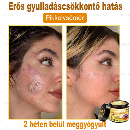 🐝🐝🐝APKAPK® Méhméreg Átfogó Krém🔥 Magyar fejlesztés, magyarországi gyártás és szállítás