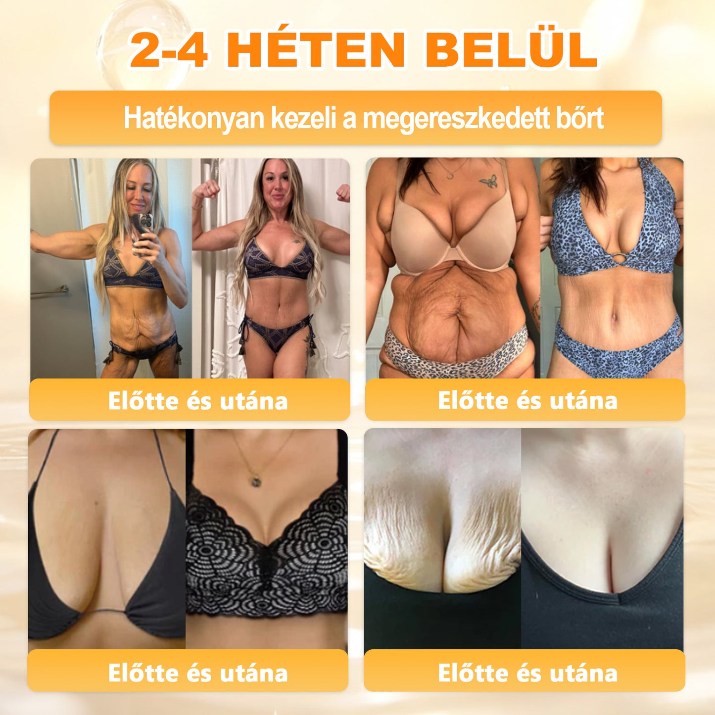 💜APKAPK® 𝐌É𝐇𝐌É𝐑𝐄𝐆 Á𝐓𝐅𝐎𝐆Ó 𝐊𝐑É𝐌🥇🥇🥇𝐀 bőrnövedékek 𝐤𝐞𝐳𝐞𝐥é𝐬𝐞 𝐦𝐚𝐠á𝐛𝐚𝐧 𝐟𝐨𝐠𝐥𝐚𝐥𝐣𝐚: é𝐥𝐞𝐭𝐤𝐨𝐫𝐢 𝐟𝐨𝐥𝐭𝐨𝐤, 𝐡𝐞𝐠𝐞𝐤, 𝐬𝐳𝐞𝐦ö𝐥𝐜𝐬ö𝐤, 𝐛ö𝐫𝐧ö𝐯𝐞𝐝é𝐤𝐞𝐤, 𝐭á𝐥𝐲𝐨𝐠𝐨𝐤, 𝐩𝐚𝐭𝐭𝐚𝐧á𝐬𝐨𝐤, 𝐞𝐤𝐜é𝐦𝐚, 𝐩𝐬𝐨𝐫𝐢𝐚𝐬𝐢𝐬, 𝐚𝐜𝐧𝐞 𝐢𝐧𝐯𝐞𝐫𝐬𝐚, 𝐫á𝐧𝐜𝐨𝐤, 𝐛ö𝐫ö𝐫𝐞𝐠𝐞𝐝é𝐬 é𝐬 𝐞𝐠𝐲é𝐛 𝐩𝐫𝐨𝐛𝐥é𝐦á𝐤🔥