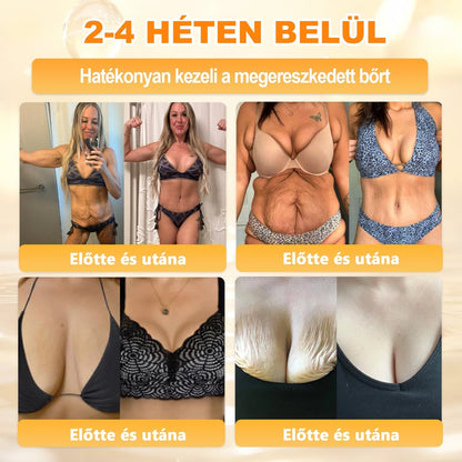 🍯 𝖠𝖯𝖪𝖠𝖯𝖪® Méhméreg Bőr Helyreállító Krém 🔥 Magyar fejlesztés, magyarországi gyártás és szállítás