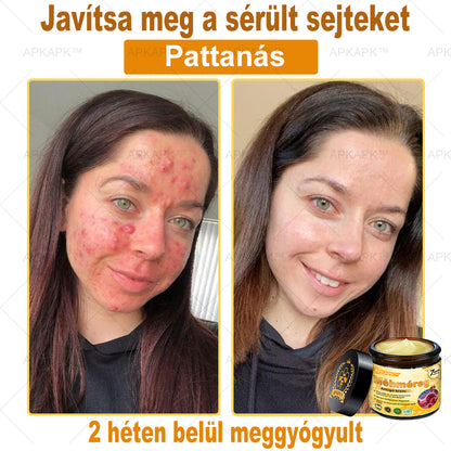🐝🐝🐝APKAPK® Méhméreg Átfogó Krém🔥 Magyar fejlesztés, magyarországi gyártás és szállítás