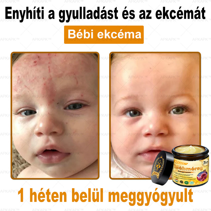 🐝🐝🐝APKAPK® Méhméreg Átfogó Krém🔥 Magyar fejlesztés, magyarországi gyártás és szállítás