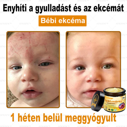 🐝🐝🐝APKAPK® Méhméreg Átfogó Krém🔥 Magyar fejlesztés, magyarországi gyártás és szállítás