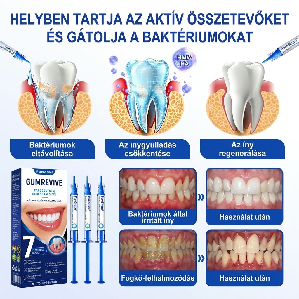 PureShade® 🦷🦷🦷 GumRevive Ínyregeneráló Gél – Az egészségesebb ínyért és magabiztosabb mosolyért 👍