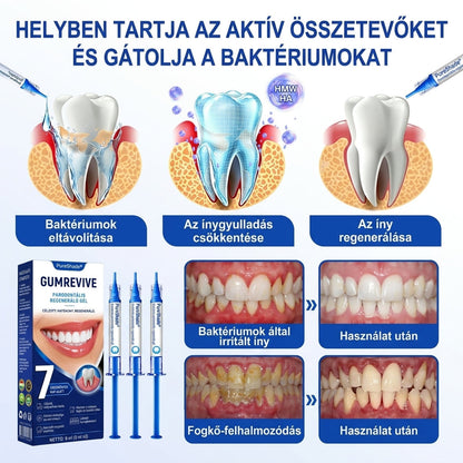 PureShade® 🦷🦷🦷 GumRevive Ínyregeneráló Gél – Az egészségesebb ínyért és magabiztosabb mosolyért 👍