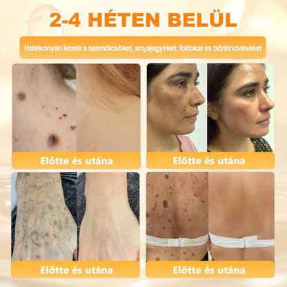 🍯 𝖠𝖯𝖪𝖠𝖯𝖪® Méhméreg Bőr Helyreállító Krém 🔥 Magyar fejlesztés, magyarországi gyártás és szállítás