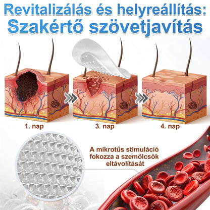 PURESHADE® 2 az 1-ben mikrotűs és hidrokolloid tapasz🍀🍀 | Kiálló anyajegyek, aknék, lapos szemölcsök és bőrnövedékek eltávolítására | Segít csökkenteni a ráncokat, hegeket és bőrhibákat | Láthatatlan tapasz az arcra és testre