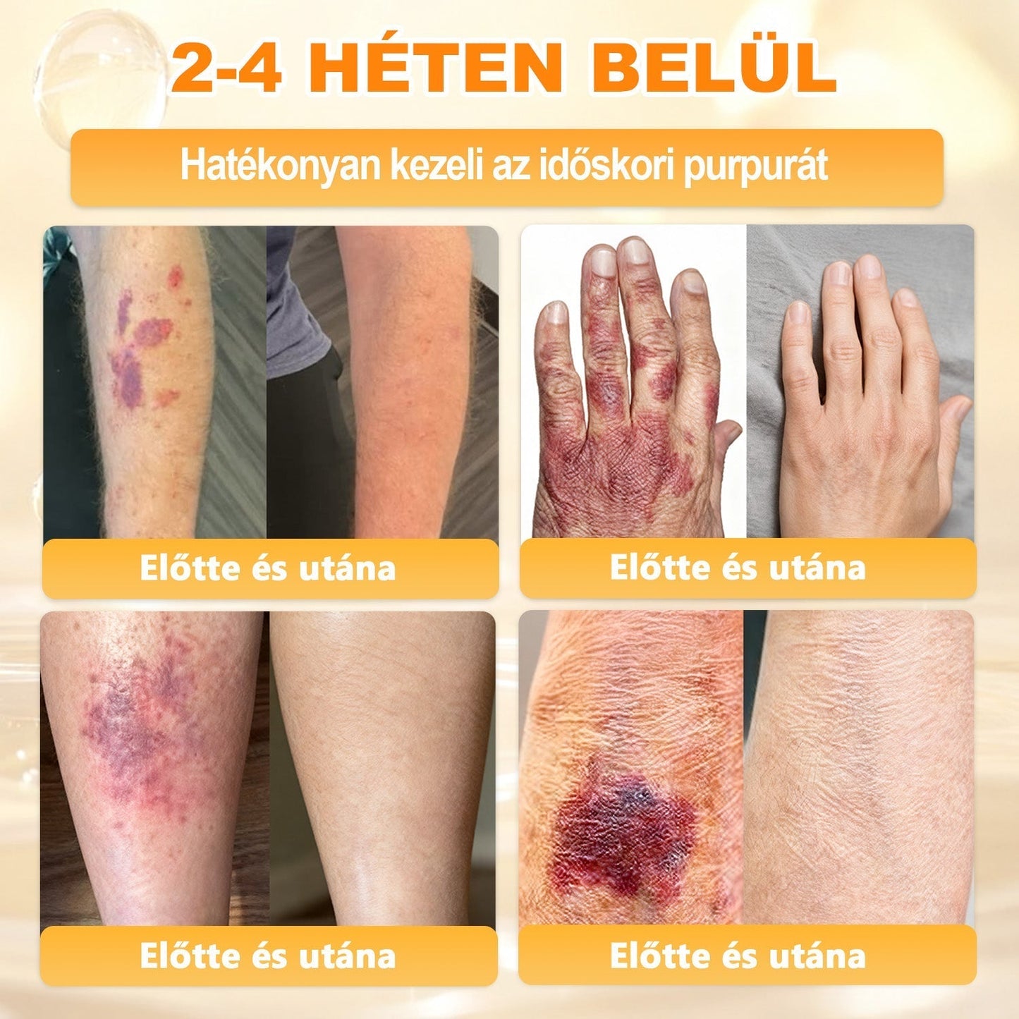 🍯 𝖠𝖯𝖪𝖠𝖯𝖪® Méhméreg Bőr Helyreállító Krém 🔥 Magyar fejlesztés, magyarországi gyártás és szállítás
