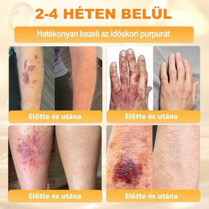 🍯 𝖠𝖯𝖪𝖠𝖯𝖪® Méhméreg Bőr Helyreállító Krém 🔥 Magyar fejlesztés, magyarországi gyártás és szállítás