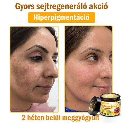 🐝🐝🐝APKAPK® Méhméreg Átfogó Krém🔥 Magyar fejlesztés, magyarországi gyártás és szállítás