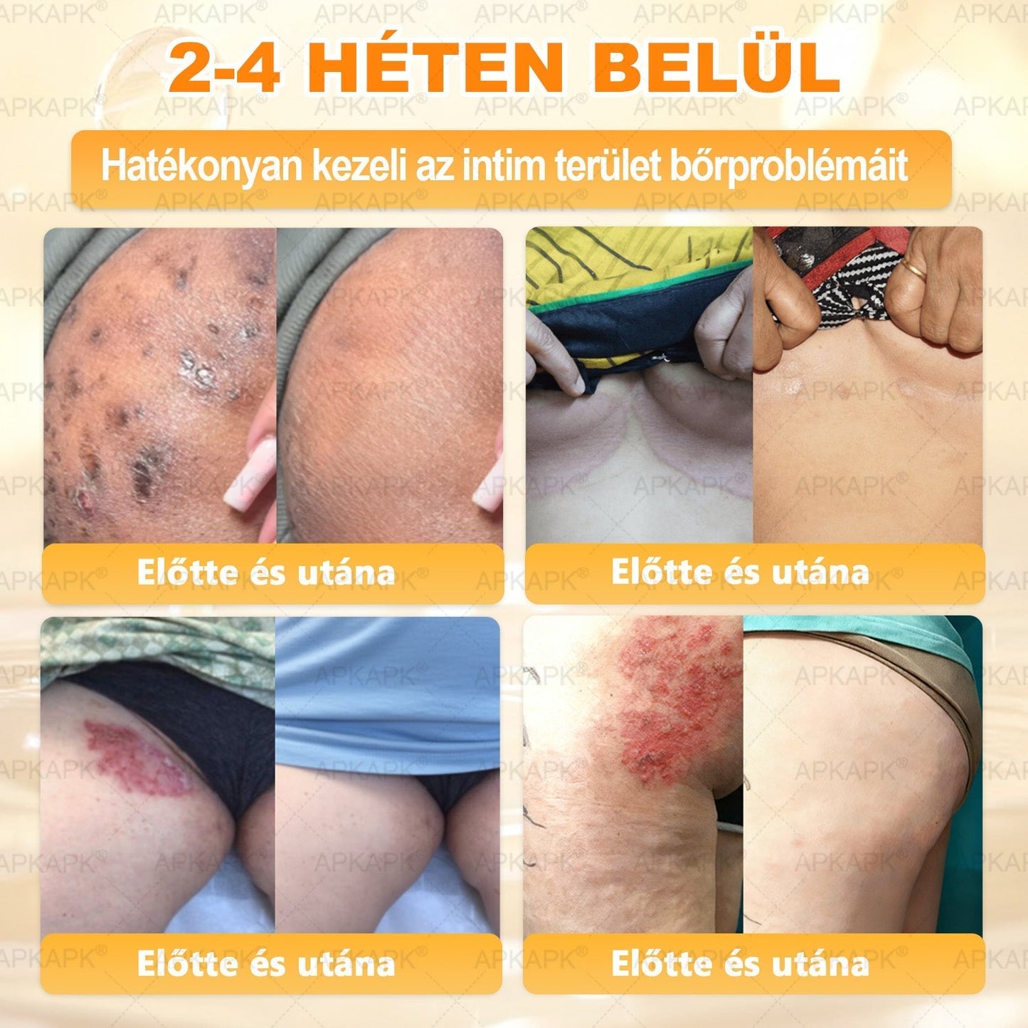 🍯 𝖠𝖯𝖪𝖠𝖯𝖪® Méhméreg Bőr Helyreállító Krém 🔥 Magyar fejlesztés, magyarországi gyártás és szállítás