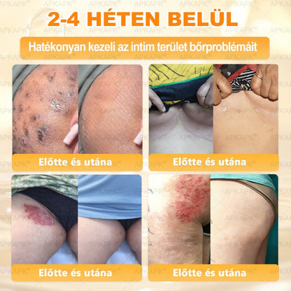 🍯 𝖠𝖯𝖪𝖠𝖯𝖪® Méhméreg Bőr Helyreállító Krém 🔥 Magyar fejlesztés, magyarországi gyártás és szállítás