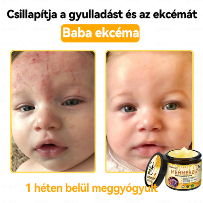 💜💜APKAPK® 𝐌É𝐇𝐌É𝐑𝐄𝐆 Á𝐓𝐅𝐎𝐆Ó 𝐊𝐑É𝐌🥇𝐀 bőrnövedékek 𝐤𝐞𝐳𝐞𝐥é𝐬𝐞 𝐦𝐚𝐠á𝐛𝐚𝐧 𝐟𝐨𝐠𝐥𝐚𝐥𝐣𝐚: é𝐥𝐞𝐭𝐤𝐨𝐫𝐢 𝐟𝐨𝐥𝐭𝐨𝐤, 𝐡𝐞𝐠𝐞𝐤, 𝐬𝐳𝐞𝐦ö𝐥𝐜𝐬ö𝐤, 𝐛ö𝐫𝐧ö𝐯𝐞𝐝é𝐤𝐞𝐤, 𝐭á𝐥𝐲𝐨𝐠𝐨𝐤, 𝐩𝐚𝐭𝐭𝐚𝐧á𝐬𝐨𝐤, 𝐞𝐤𝐜é𝐦𝐚, 𝐩𝐬𝐨𝐫𝐢𝐚𝐬𝐢𝐬, 𝐚𝐜𝐧𝐞 𝐢𝐧𝐯𝐞𝐫𝐬𝐚, 𝐫á𝐧𝐜𝐨𝐤, 𝐛ö𝐫ö𝐫𝐞𝐠𝐞𝐝é𝐬 é𝐬 𝐞𝐠𝐲é𝐛 𝐩𝐫𝐨𝐛𝐥é𝐦á𝐤🔥