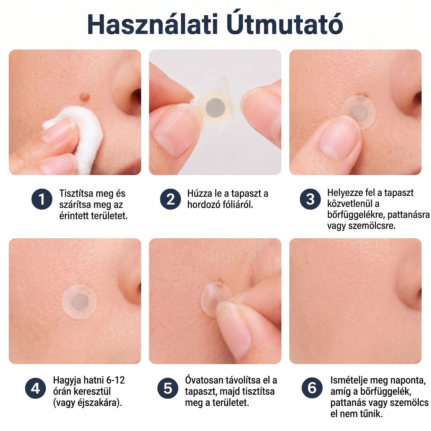 PURESHADE® 2 az 1-ben mikrotűs és hidrokolloid tapasz🍀🍀 | Kiálló anyajegyek, aknék, lapos szemölcsök és bőrnövedékek eltávolítására | Segít csökkenteni a ráncokat, hegeket és bőrhibákat | Láthatatlan tapasz az arcra és testre