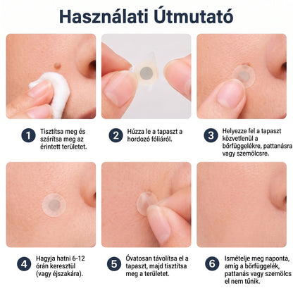 PURESHADE® 2 az 1-ben mikrotűs és hidrokolloid tapasz🍀🍀 | Kiálló anyajegyek, aknék, lapos szemölcsök és bőrnövedékek eltávolítására | Segít csökkenteni a ráncokat, hegeket és bőrhibákat | Láthatatlan tapasz az arcra és testre