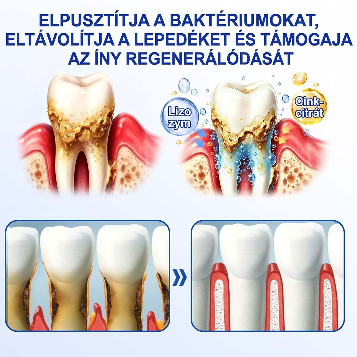 PureShade® 🦷🦷🦷 GumRevive Ínyregeneráló Gél – Az egészségesebb ínyért és magabiztosabb mosolyért 👍