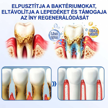PureShade® ✨ GumRevive Ínyregeneráló Gél – Az egészségesebb ínyért és magabiztosabb mosolyért 👍