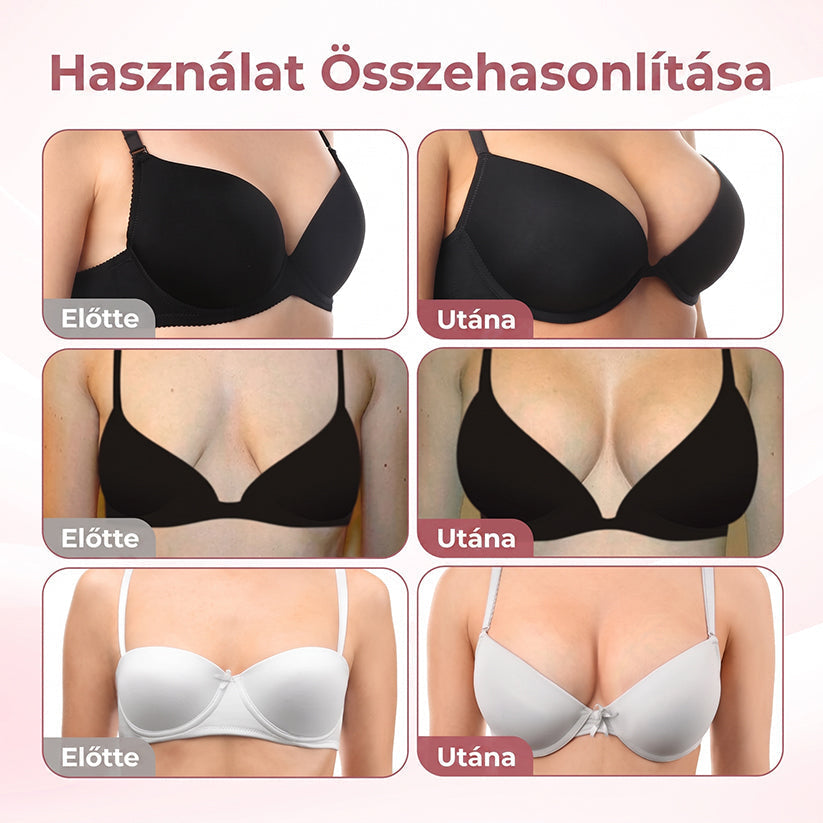 ❤️❤️❤️HISKIN® MELLEMELŐ ÉS FESZESÍTŐ MIKROTŰS TAPASZOK