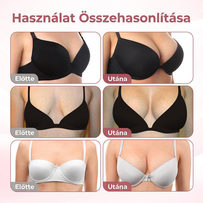 ❤️❤️❤️HISKIN® MELLEMELŐ ÉS FESZESÍTŐ MIKROTŰS TAPASZOK
