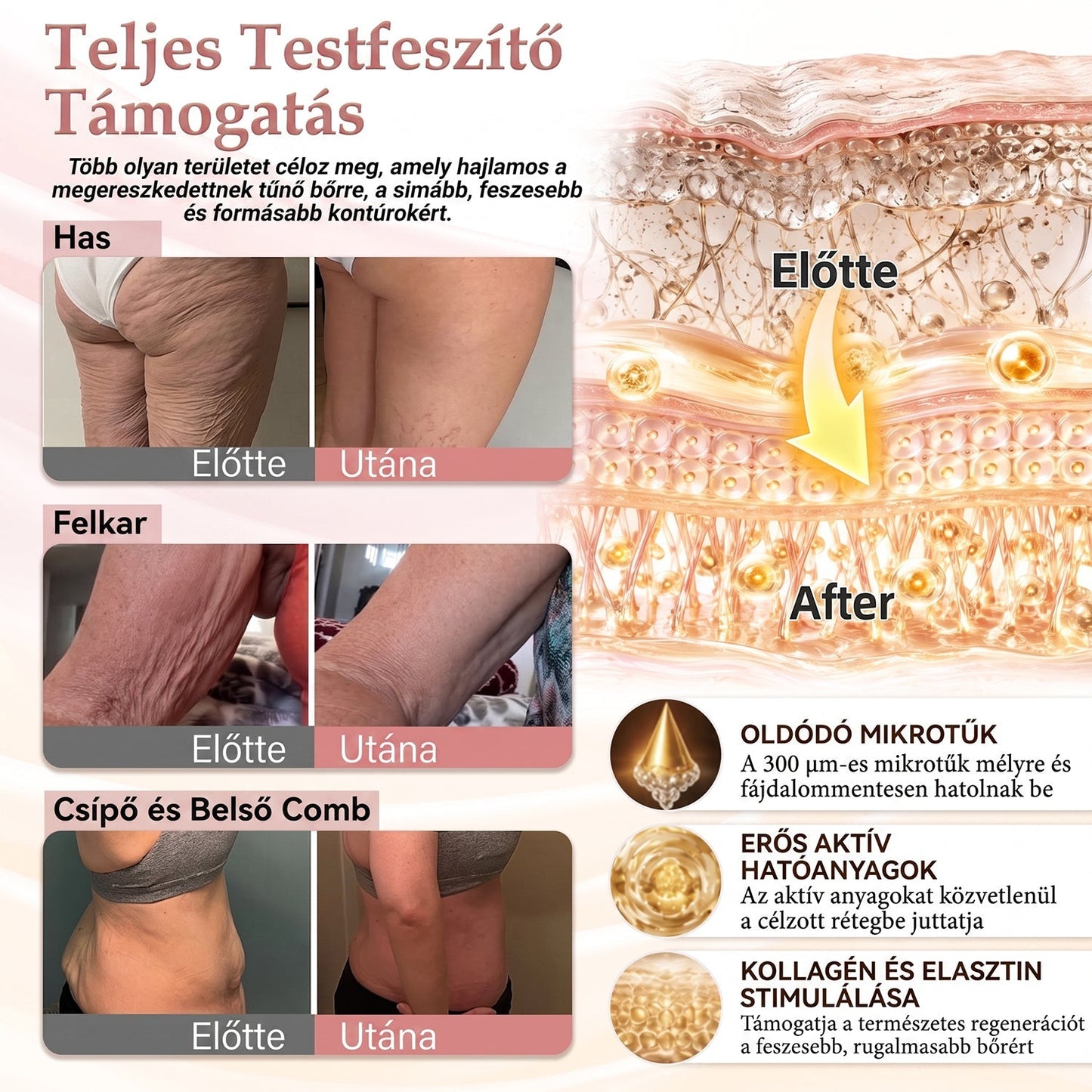 ❤️❤️❤️HISKIN® MELLEMELŐ ÉS FESZESÍTŐ MIKROTŰS TAPASZOK