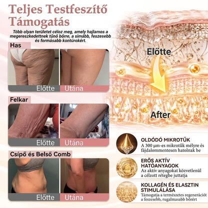 ❤️❤️❤️HISKIN® MELLEMELŐ ÉS FESZESÍTŐ MIKROTŰS TAPASZOK