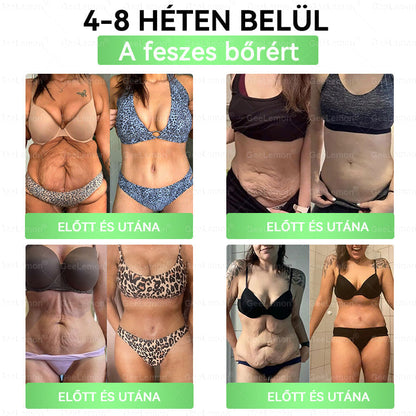 Ajánlott a Semmelweis Kórház által · 👩‍⚕️👩‍⚕️ 𝐆𝐞𝑒𝐿𝑒𝐦𝐨𝐧® Glumasetide 8 az 1-ben Karcsú és Egészséges Nano Mikrotűs Tapasz 🇭🇺