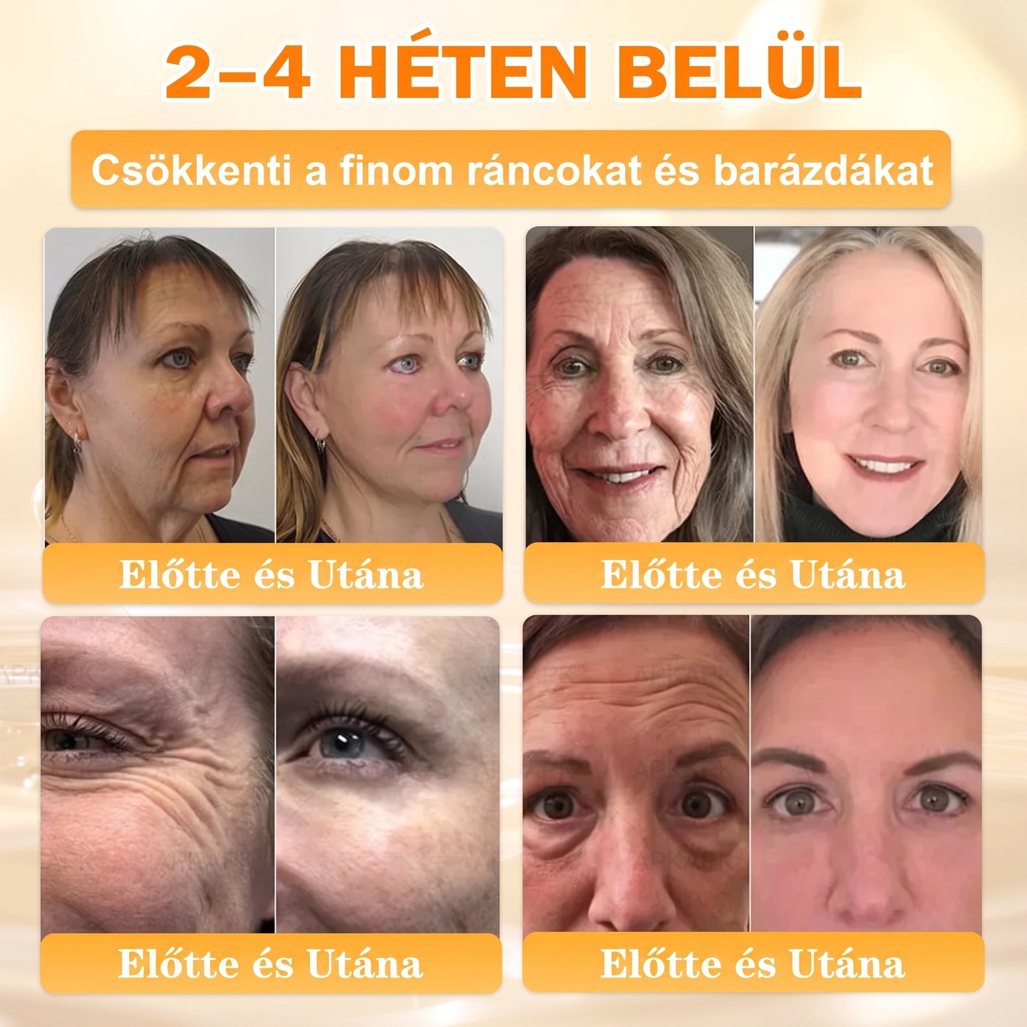 🍯 𝖠𝖯𝖪𝖠𝖯𝖪® Méhméreg Bőr Helyreállító Krém 🔥 Magyar fejlesztés, magyarországi gyártás és szállítás