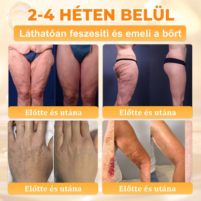 🍯 𝖠𝖯𝖪𝖠𝖯𝖪® Méhméreg Bőr Helyreállító Krém 🔥 Magyar fejlesztés, magyarországi gyártás és szállítás