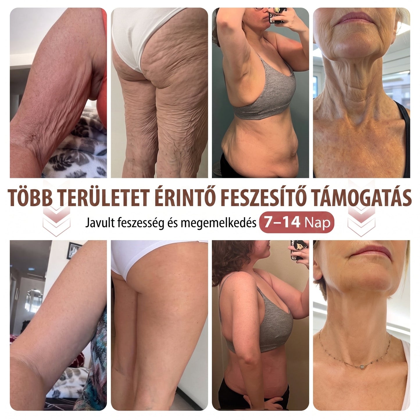 ❤️❤️❤️HISKIN® MELLEMELŐ ÉS FESZESÍTŐ MIKROTŰS TAPASZOK